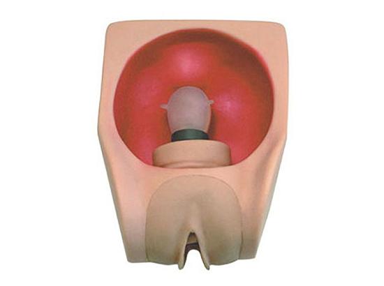 KM/T34B Female Contraception Simulator